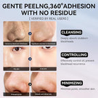 LANBENA 3-in-1 Blackhead Removal Set - Image 7