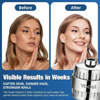 Yodel Shower Filter for Hard Water - Image 4