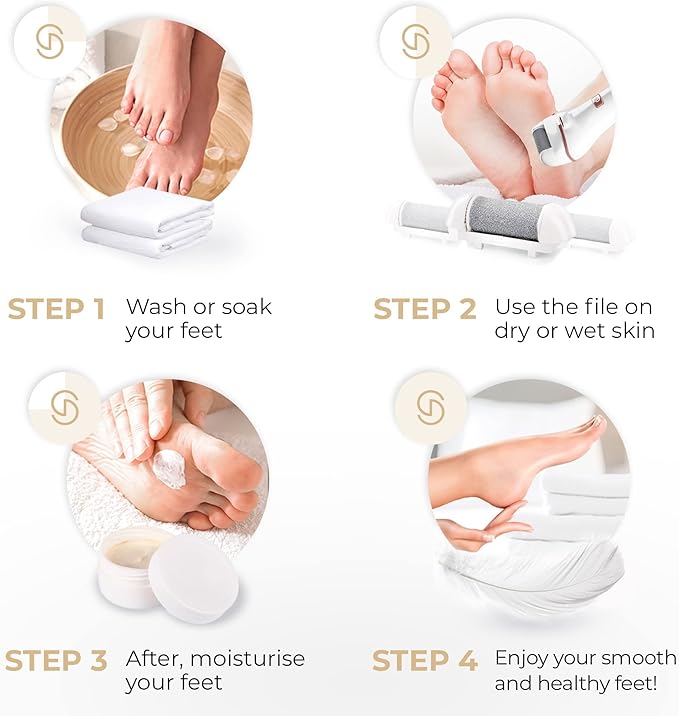 Essy Electric Foot File Hard Skin Remover - Image 5