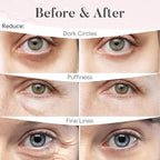 BLOOMORA Rose Under Eye Patches - Image 4