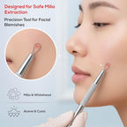 Suvorna Pimple Popper Tool Kit | Milia Remover | Lancets - Image 4