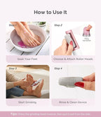 MelodySusie Electric Callus Remover - Image 7