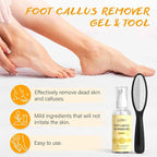 Pedicure Kit For Feet 5pcs Foot Spa Set For Christmas Birthday Valentine's - Image 3
