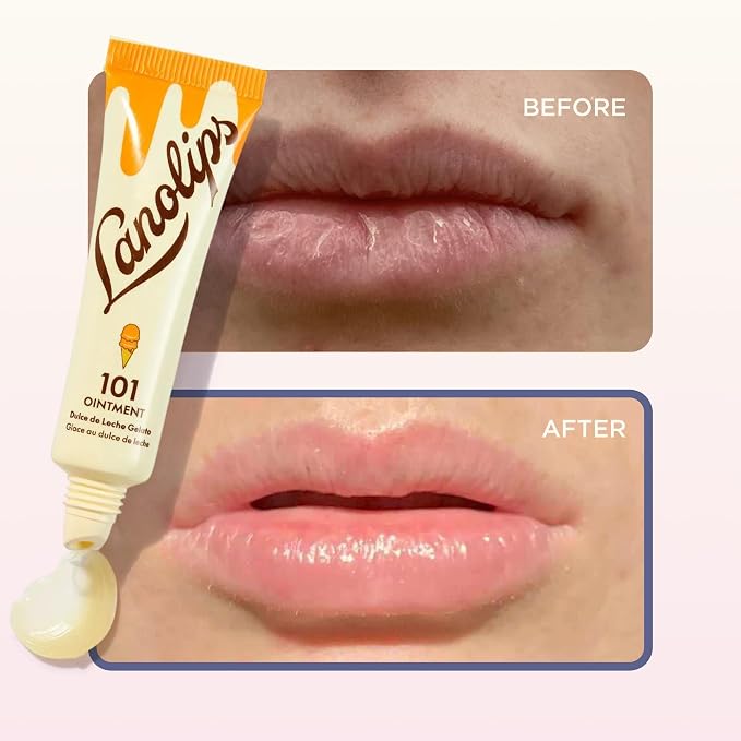 Lanolin 101 Multipurpose Ointment - Image 5