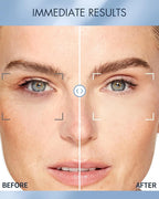 depology Replenish & Repair Under Eye Patches - Image 4