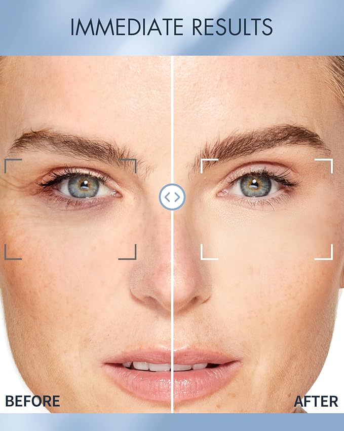 depology Replenish & Repair Under Eye Patches - Image 4
