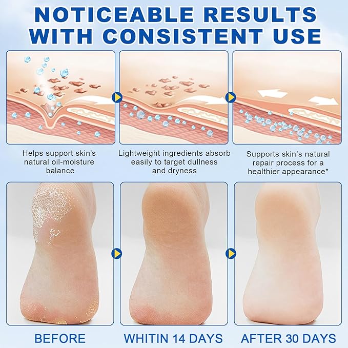 60% Urea with 2% Salicylic Acid Urea Foot Care Stick, Foot Cream Moisturizer - Image 5