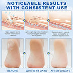 60% Urea with 2% Salicylic Acid Urea Foot Care Stick, Foot Cream Moisturizer - Image 5