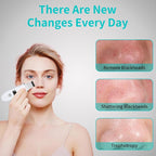 Face Scrubber Skin Spatula - Image 6