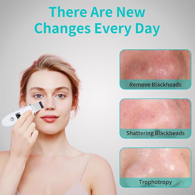 Face Spatula Blackhead Remover - Image 6