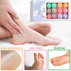 Foot Bath Bombs 12 Pack, Organic Foot Soak - Image 2