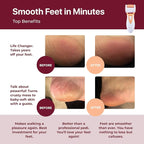 Rechargeable Callus Remover for Feet: Professional Electric Feet Sander for - Image 2