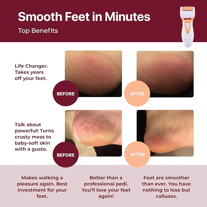 Rechargeable Callus Remover for Feet: Professional Electric Feet Sander for - Image 2