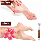 Callus Shaver, Foot Shaver Callus Remover - Image 7