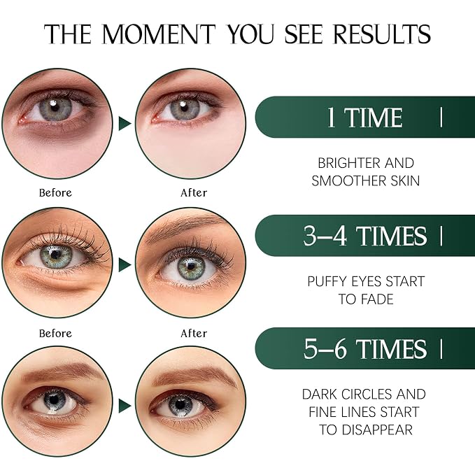 Tiepetly Under Eye Masks, Collagen Eye Mask, Under Eye Patches - Image 3