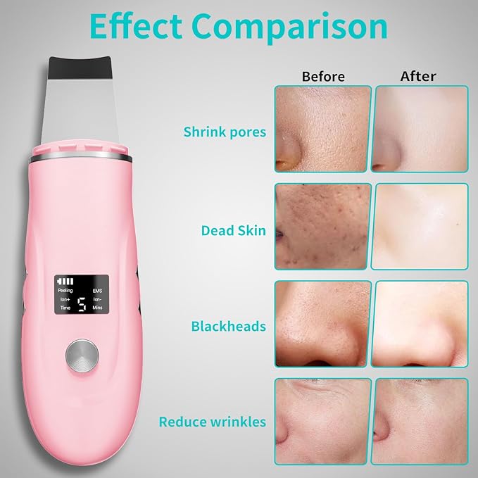 Face Scrubber Skin Spatula - Image 3