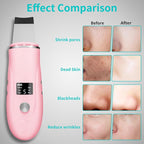 Face Scrubber Skin Spatula - Image 3