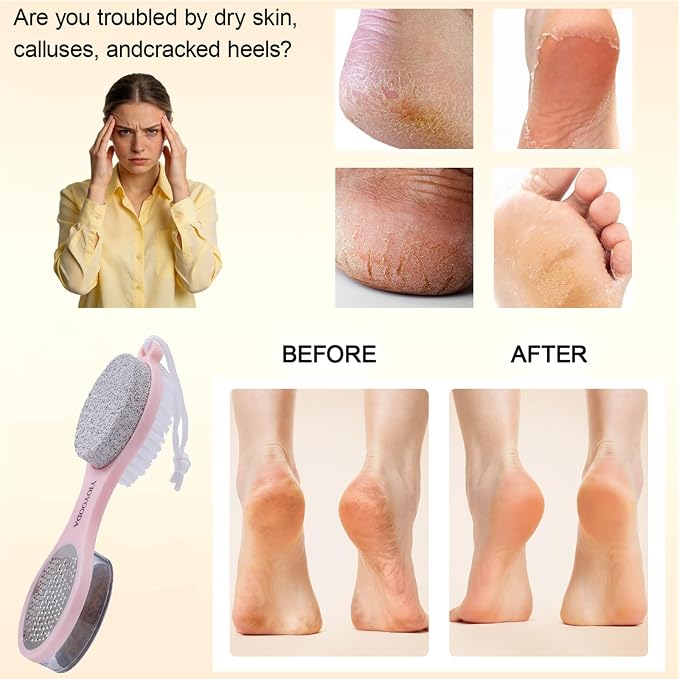 Foot Scrubber Brush with Pumice Stone - Image 3
