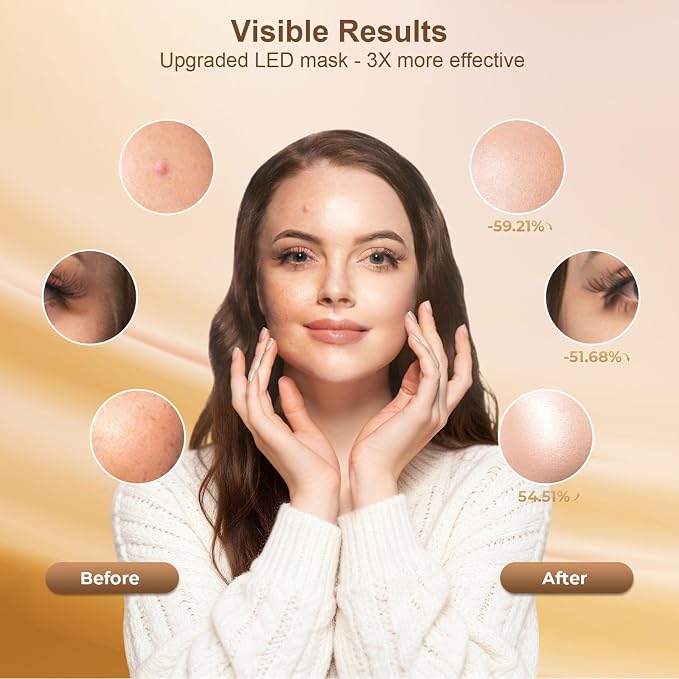 Red Light Therapy for Face, LED Face Mask Light Therapy, Rechargeable Red Light - Image 3