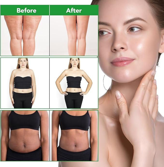 Body Oil Naturals Anti Cellulite Massage Oil, - Image 4