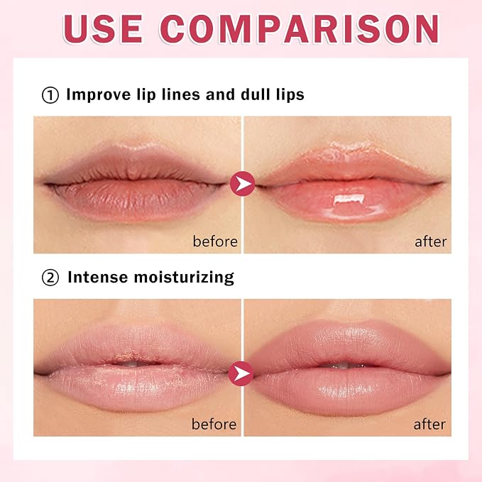 10PCS Honey Pot Lip Balm, Moisturizing Bee Lip Balm, Fruity Lip Sleeping Mask - Image 4