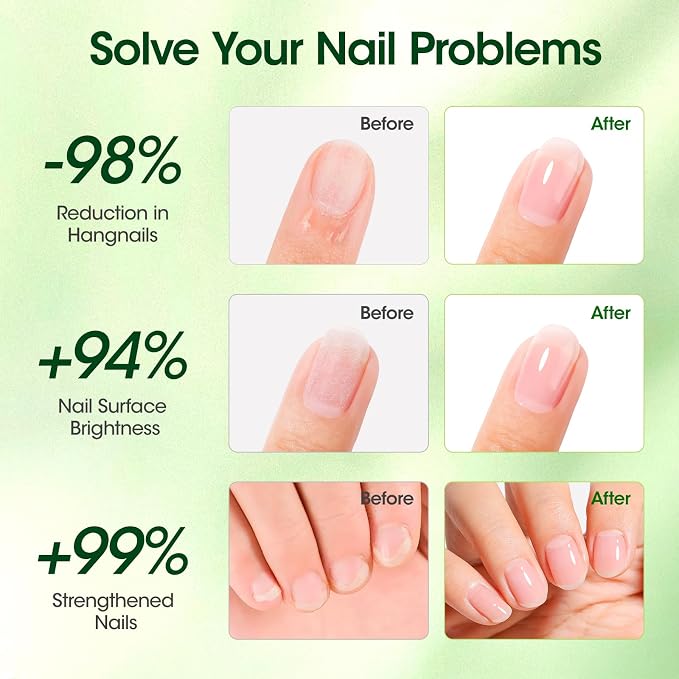Gellen Cuticle Oil, Roll-On Nail Growth Oil, Nail Oil - Image 4