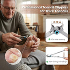 LIONVISON Ingrown Toenail Removal Kit: 8 Pcs Professional Toenail Clippers - Image 6