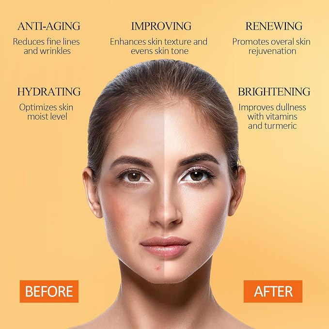 SHVYOG Turmeric Vitamin C Clay Mask - Image 5
