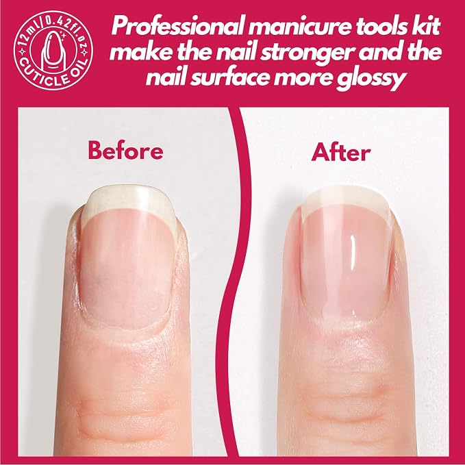 FANDAMEI Nail Files and Buffers, Nail Care Kit - Image 7