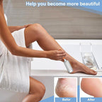 Professional Foot Scrubber Dead Skin Remover, Pedicure Foot File Callus Removal - Image 5