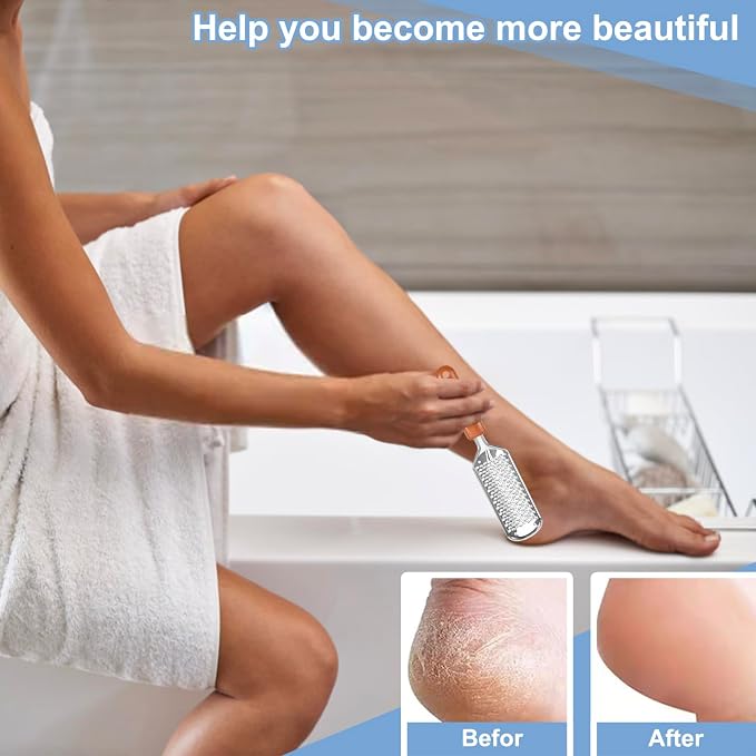 Professional Foot Scrubber Dead Skin Remover, Pedicure Foot File Callus Removal - Image 5
