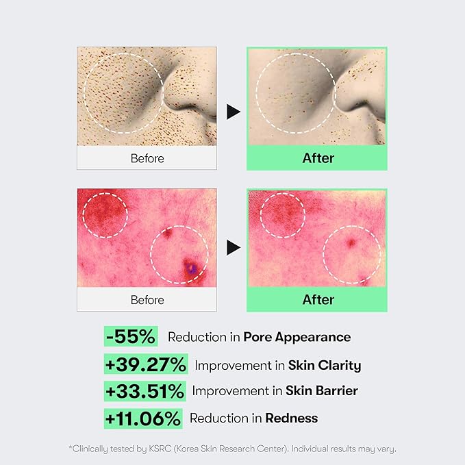VT COSMETICS CICA Reedle Shot 100, Spicule Microneedling Serum - Image 6