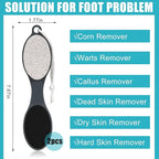Foot File Callus Remover-3 Pcs 4 in 1 Foot Scrubber Dead Skin Remover - Image 3