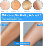 Exfoliating Gloves 2 Pcs, Exfoliating Body Scrubber - Image 5