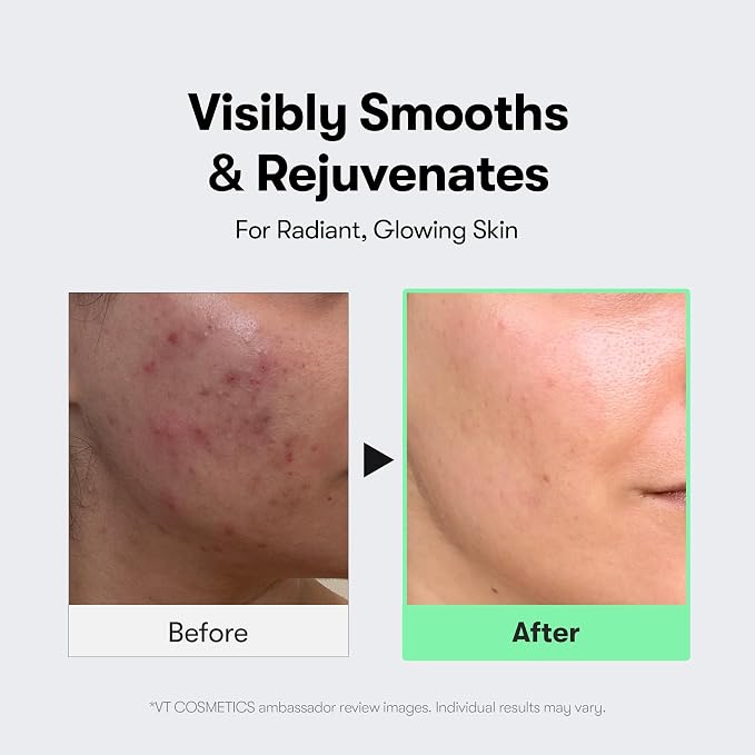 VT COSMETICS CICA Reedle Shot 300, Advanced Night Exosome, Microneedling Serum - Image 5