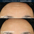 RoC Retinol Correxion Anti-Aging Wrinkle Night Serum, Retinol Serum - Image 4