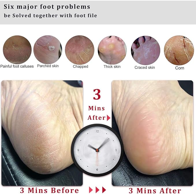 Kinepi Foot Scrubber Pedicure Foot File Pumice Stone, Professional Pedicure - Image 4