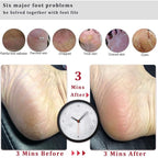 Kinepi Foot Scrubber Pedicure Foot File Pumice Stone, Professional Pedicure - Image 4