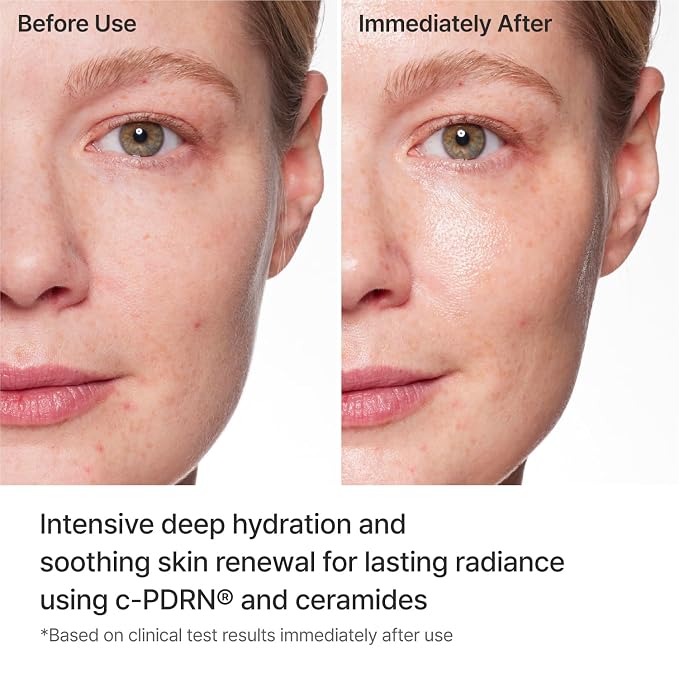 REJURAN® Turnover Mask, c-PDRN® – Original Salmon DNA - Image 4