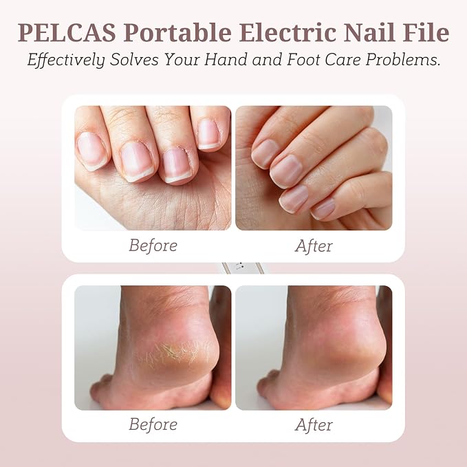PELCAS Electric Nail File, 5 Speeds Nail Grinder - Image 2