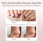 PELCAS Electric Nail File, 5 Speeds Nail Grinder - Image 2