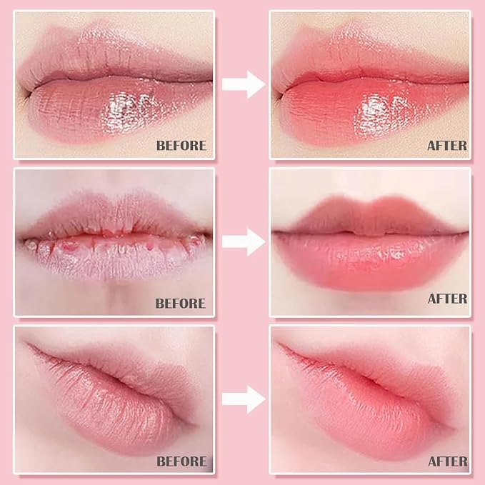 6Pcs Bee Lip Balm Honey Pot, Strawberry, Watermelon, Apple Lime, Honey Lip Balm - Image 9
