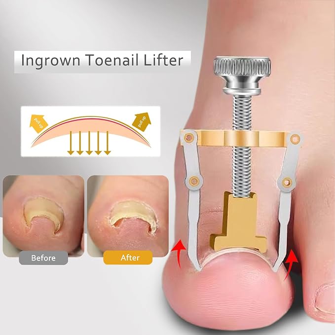 Toenail Clipper for Thick Nails Seniors Ingrown Toe Nail Pedicure Knife for - Image 6