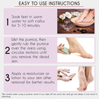 Karlash Professional Pedicure Foot Pumice Stone - Image 4