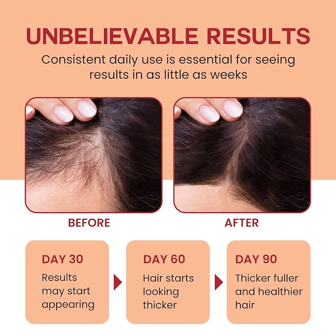 Lebanta Raw Batana Oil for Hair Growth - Image 3