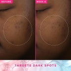 Farmacy 3% TXA Brightening Toner - Image 4