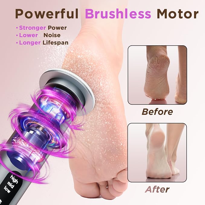 Electric Foot Callus Remover - Image 4