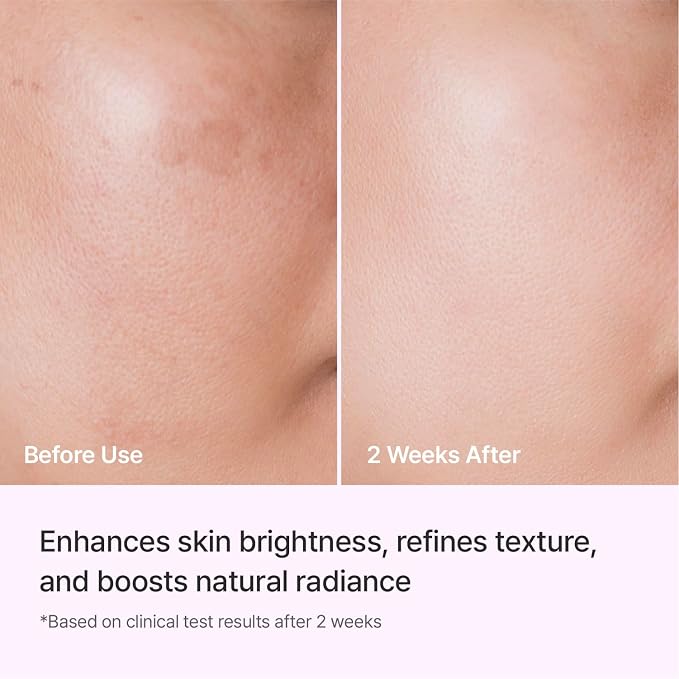 REJURAN® Triple Radiance Ampoule 30ml – DOT™ c-PDRN 0.5% Serum - Image 5