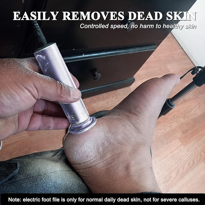 Upgraded Electric Callus Remover - Image 2