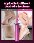 FSA&HSA Electric Foot File - Image 9